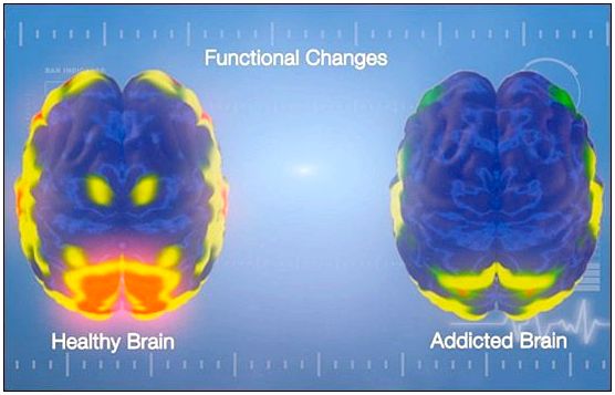 Зависимый мозг: анатомия принуждения и потребности