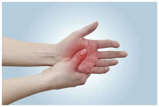 Ревматоидный артрит: симптомы, причины и лечение