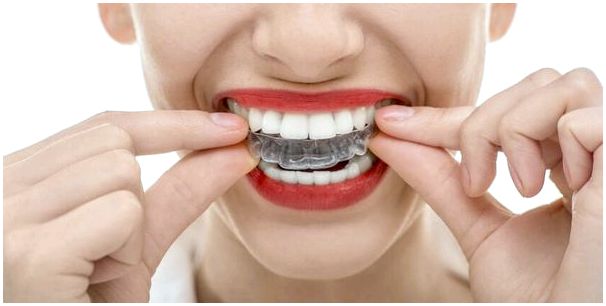 Бруксизм и причины скрежета зубами