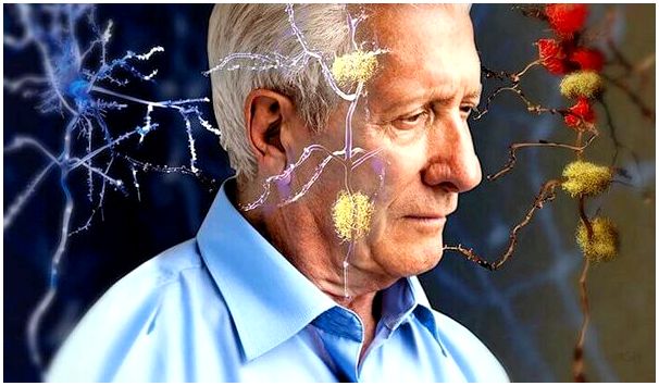 5 признаков, предшествующих болезни Альцгеймера