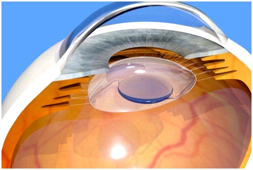 Хирургия катаракты: как мозг воспринимает визуальные изменения?