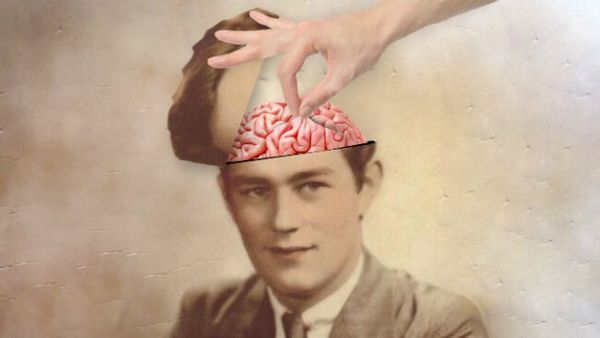 Три клинических случая, изменивших наши представления о мозге