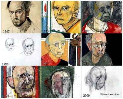 Эволюция болезни Альцгеймера через искусство